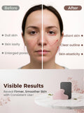 Sha Facial Tool — Scraping Massage Tool for Acupuncture Therapy & Trigger Point